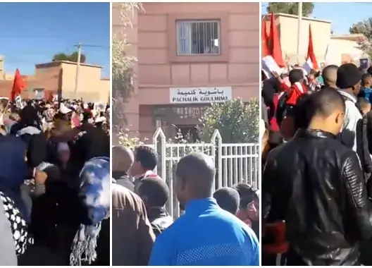 كلاب ضالة نهشت وجه الطفل “يحيى” تشعل احتجاجات بكلميمة