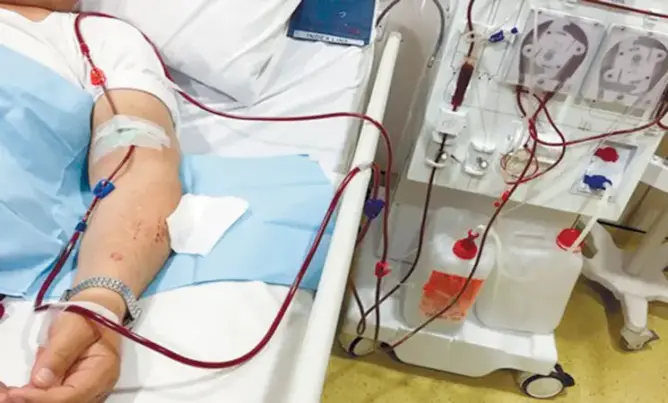 الـ”CNOPS” يعتمد رقمنة طلبات تحمل حصص تصفية الكلي