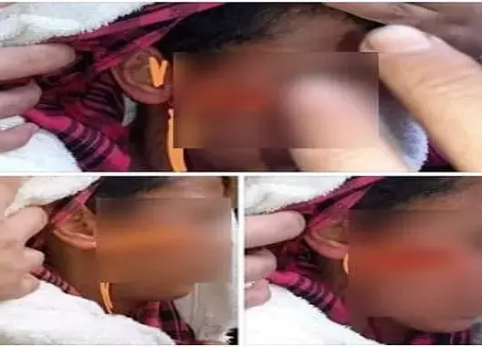 أمن فاس يوضح حقيقة تعرض قاصر لعنف إنتقامي من سيدة
