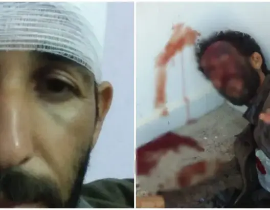 بسبب المساعدات .. مواطن يتهم رئيس جماعة بإقليم الصويرة بتعنيفه
