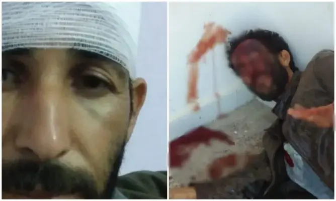 بسبب المساعدات .. مواطن يتهم رئيس جماعة بإقليم الصويرة بتعنيفه