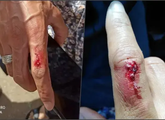 قائد بمدينة تيفلت يعتدي على طاقم قناة الأمازيغية بالضرب والشتم (فيديو)