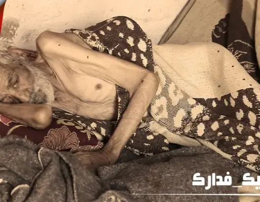 الإهمال يتسبب في وفاة “با ميلود” ضواحي مراكش في ظروف حاطة من الكرامة
