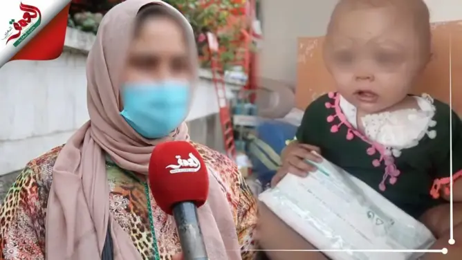 ضياء.. رضيعة ينخر السرطان جسدها ويتسبب في تشوهٍ برأسها وعائلتها تناشد المحسنين (فيديو)