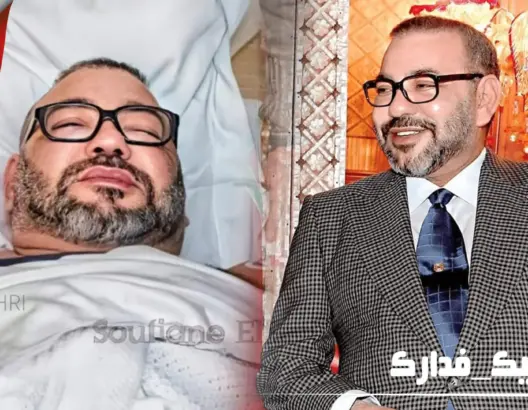 بمشاركة أطباء مغاربة.. الملك محمد السادس يجري عملية جراحية كللت بالنجاح