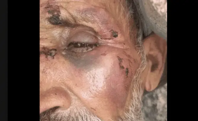 بسبب صراع حول مطفية .. شيخ يتهم عون سلطة بتعنيفه ضواحي تارودانت