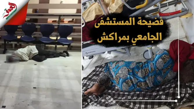 في عز “كورونا”.. انعدام التدابير الوقائية وأخطاء “قاتلة” بالمستشفى الجامعي مراكش (فيديو)