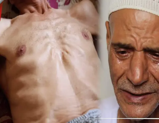 يناشد المحسنين.. ستيني يبكي ألما من السرطان: “عطلوا عليا العلاج وكنحس بالحكرة” (فيديو)