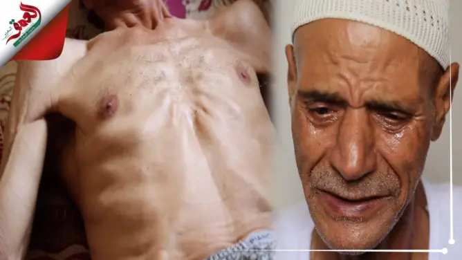 يناشد المحسنين.. ستيني يبكي ألما من السرطان: “عطلوا عليا العلاج وكنحس بالحكرة” (فيديو)