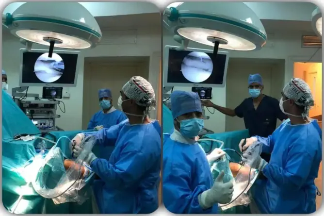 أطباء يجرون أول عملية على الركبة بإقليم الفقيه بنصالح