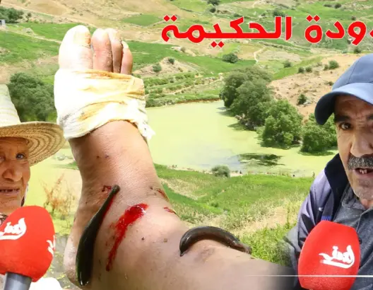 تقوم بحجامة طبيعية.. دودة حكيمة ببحيرة “شارف” بشفشاون تقاوم الانقراض (فيديو وصور)