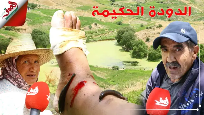 تقوم بحجامة طبيعية.. دودة حكيمة ببحيرة “شارف” بشفشاون تقاوم الانقراض (فيديو وصور)