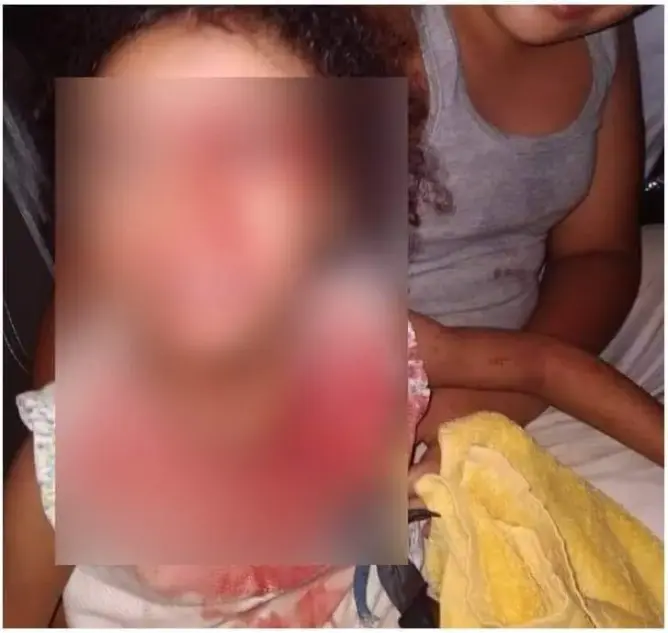 أمن الرباط يوضح بخصوص صور متداولة لطفلة تحمل جروحا على وجهها