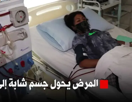 سناء .. شابة من مكناس حوّل المرض جسدها إلى طفلة صغيرة (فيديو)