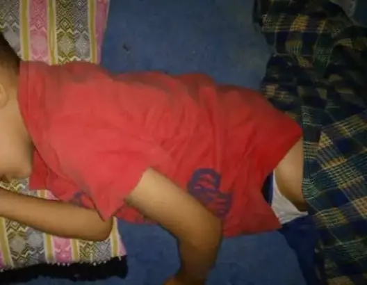 طفل ضواحي أكادير يعاني من ثقوب في عضوه التناسلي .. وأسرته تناشد المحسنين