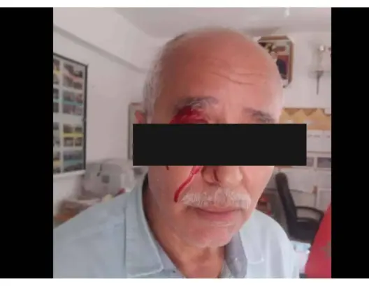 أم تلميذ تفْقأ عين مدير مدرسة بـ”لكمة”.. ومديرية التعليم بطنجة تدخل على الخط