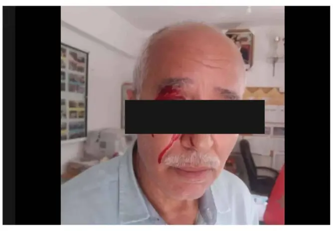 أم تلميذ تفْقأ عين مدير مدرسة بـ”لكمة”.. ومديرية التعليم بطنجة تدخل على الخط