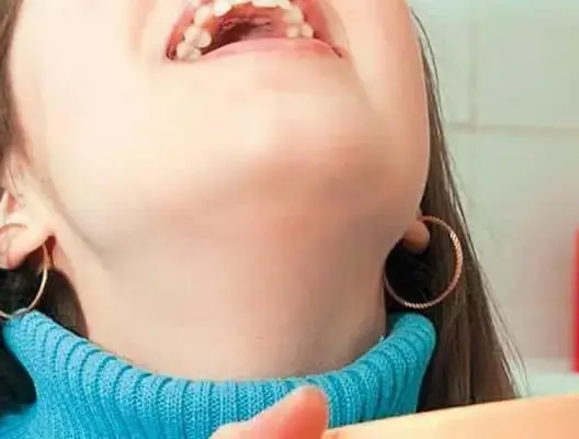 اختبار الغرغرة