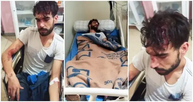 اعتداء على عضو جمعية بأوطاط الحاج