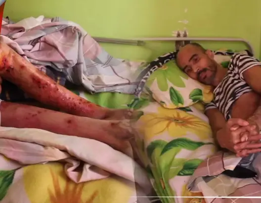 عزيز من وجدة طريح الفراش لأزيد من 15 سنة يناشد القلوب الرحيمة (فيديو)