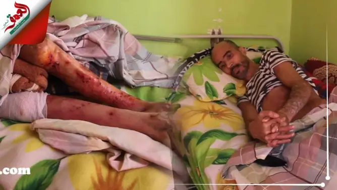 عزيز من وجدة طريح الفراش لأزيد من 15 سنة يناشد القلوب الرحيمة (فيديو)