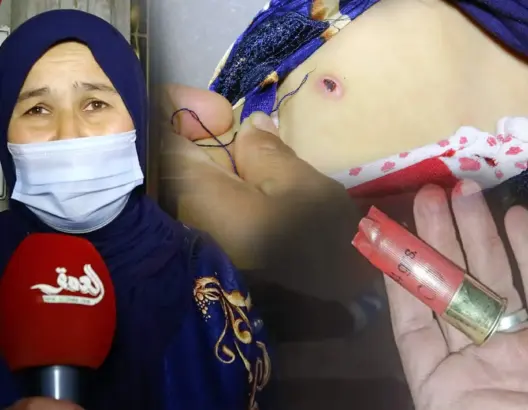 قتل الكلاب الضالة بالعرائش