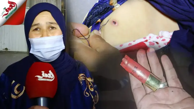 قتل الكلاب الضالة بالعرائش