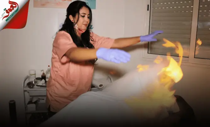 تستعمل “الفوطة النارية”.. خبيرة في الحجامة تكشف أسرار مهنة أوصى بها الرسول (فيديو)
