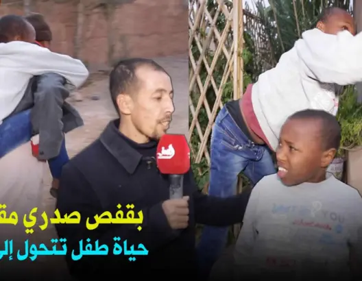 قفص صدري “مُقوَّس” يحول حياة طفل إلى جحيم.. وأسرته تناشد المحسنين (فيديو)