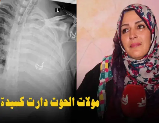 “مولات الحوت”دارْت كسيدة وتهرسو ليها 2 ضلوع