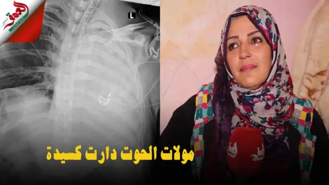 “مولات الحوت”دارْت كسيدة وتهرسو ليها 2 ضلوع