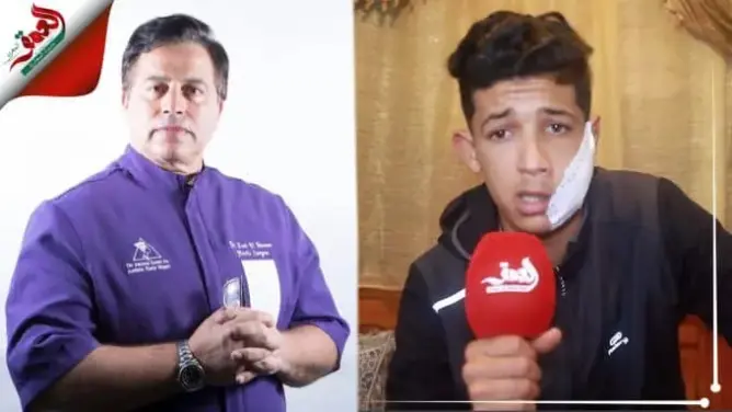 تعرض لاعتداء على مستوى الوجه.. شاب يستنجد بالدكتور التازي لمساعدته (فيديو)