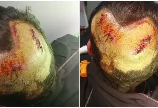 ميدلت .. مواطن يشكو إطلاق سراح شخصين حاولا قتله ويستمران في تهديده