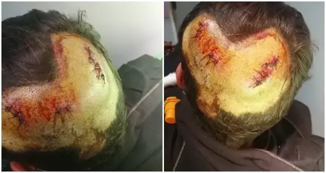 ميدلت .. مواطن يشكو إطلاق سراح شخصين حاولا قتله ويستمران في تهديده