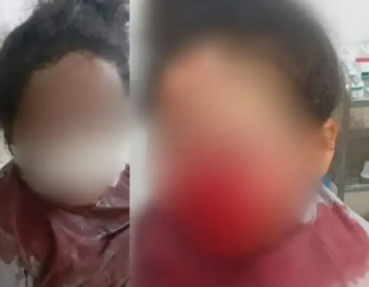 أمن طنجة يكشف تفاصيل الاعتداء على طفلة بالسلاح الأبيض