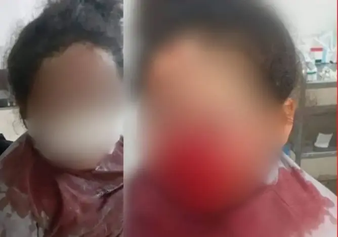 أمن طنجة يكشف تفاصيل الاعتداء على طفلة بالسلاح الأبيض