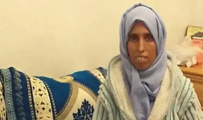 تاونات.. خديجة التي فقدت بصرها بسبب “الجلالة” ترى بصيص أمل