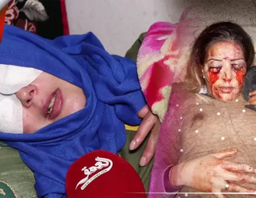 أفقدها عشيقها بصرها ثم انتحر .. الضحية سعيدة تحكي تفاصيل جريمة هزت مكناس (فيديو)
