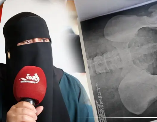 عرضت كليَتها للبيع.. نادية قصة أم تعيش رفقة زوجها وأبنائها الثلاثة ظروفا قاسية (فيديو)