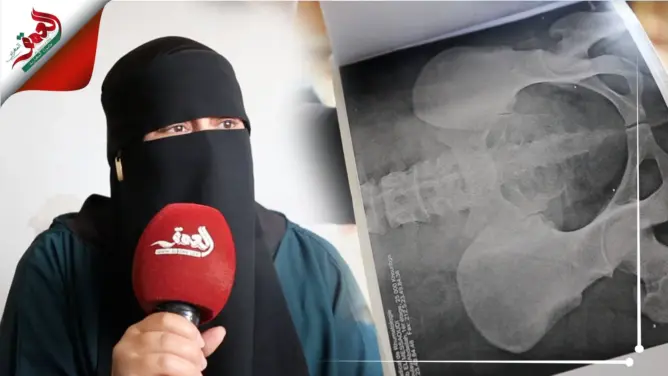 عرضت كليَتها للبيع.. نادية قصة أم تعيش رفقة زوجها وأبنائها الثلاثة ظروفا قاسية (فيديو)