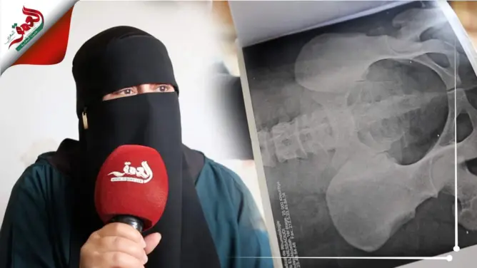 عرضت كليَتها للبيع.. نادية قصة أم تعيش رفقة زوجها وأبنائها الثلاثة ظروفا قاسية (فيديو)