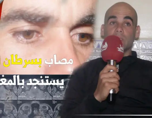 فتحي.. شاب وجدي تسببت قطرات "المازوت" في إصابته بـ"سرطان العين" ويناشد المحسنين مساعدته في العلاج