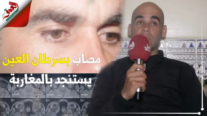 فتحي.. شاب وجدي تسببت قطرات "المازوت" في إصابته بـ"سرطان العين" ويناشد المحسنين مساعدته في العلاج