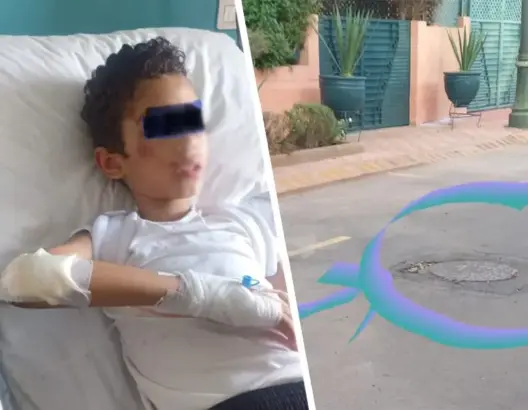 “انفجار” بالوعة بمراكش يصيب طفلا بإصابة خطيرة والشبهة تلاحق شركة خاصة