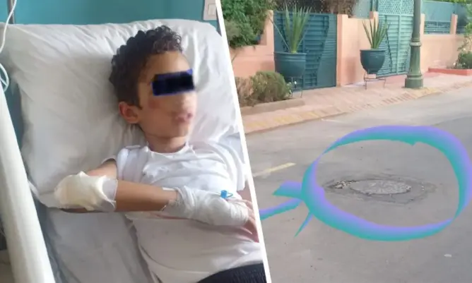 “انفجار” بالوعة بمراكش يصيب طفلا بإصابة خطيرة والشبهة تلاحق شركة خاصة