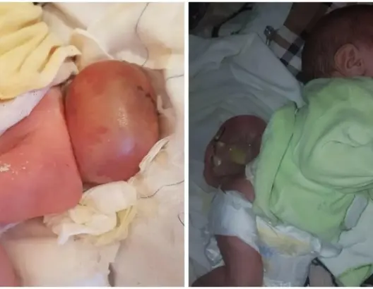 أم بضواحي أزيلال تناشد المحسنين إنقاذ ابنها المصاب بالسرطان