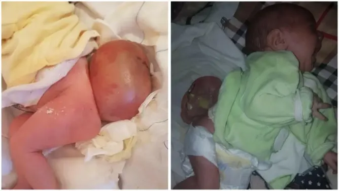 أم بضواحي أزيلال تناشد المحسنين إنقاذ ابنها المصاب بالسرطان