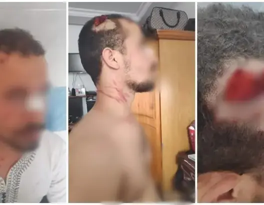 أستاذ بتطوان يتعرض لاعتداء “دموي” من طرف مديره.. ومديرية التعليم تتدخل (فيديو)