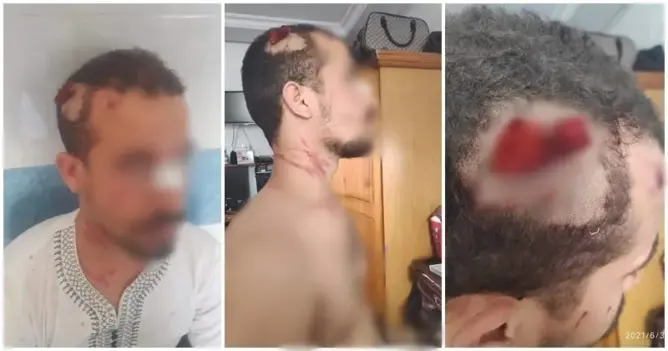 أستاذ بتطوان يتعرض لاعتداء “دموي” من طرف مديره.. ومديرية التعليم تتدخل (فيديو)