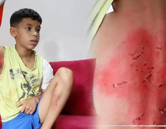 المتهم على خلاف مع أب الضحية..كلاب شرسة تفترس طفلا بالبيضاء والأم تدعو لإنصافها بعد فرار الفاعل